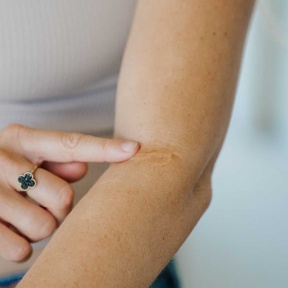 Scarsies Silicone Scar Gel