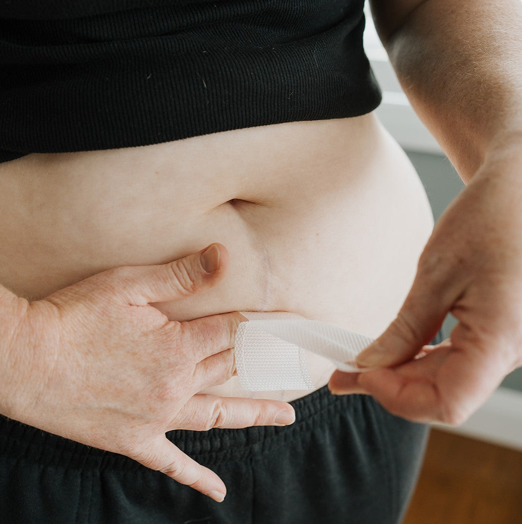 Scarsies Silicone Scar Tape